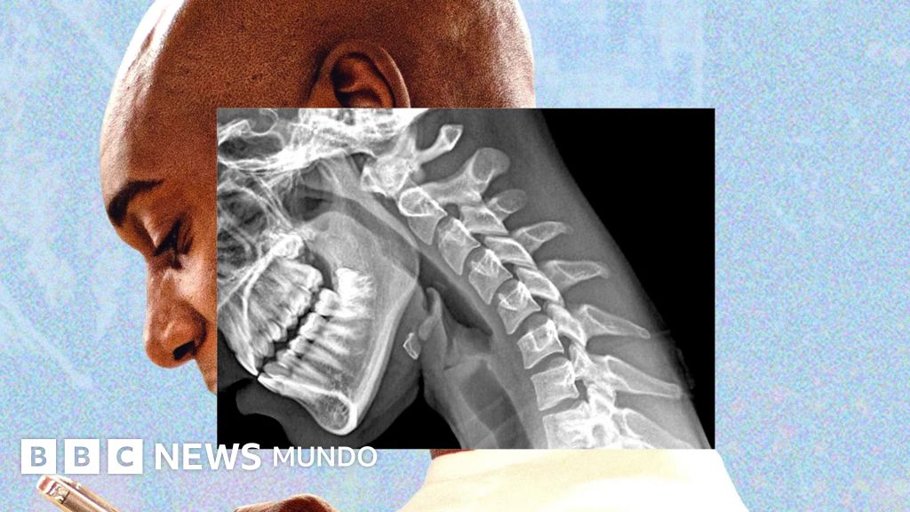 Imagen para: "Cuerpo de teléfono": cómo la tecnología arruga el cuello y debilita las manos